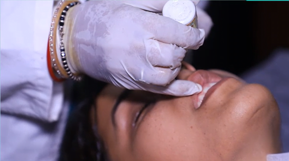 Nose ayurvedic treatment