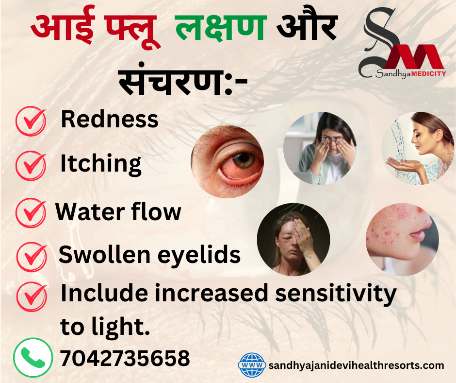 causes and prevention of eye flu